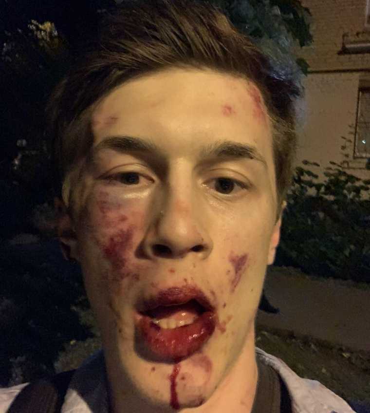 Студента ВШЭ Жукова, участвовавшего в протестах, избили у дома. ФОТО