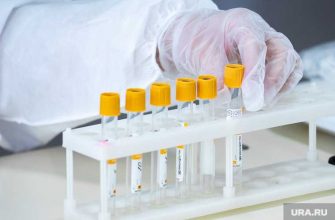 иммунолог усомнился в официальной статистике по коронавирусу