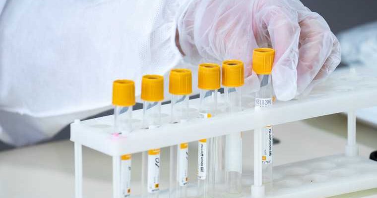 иммунолог усомнился в официальной статистике по коронавирусу