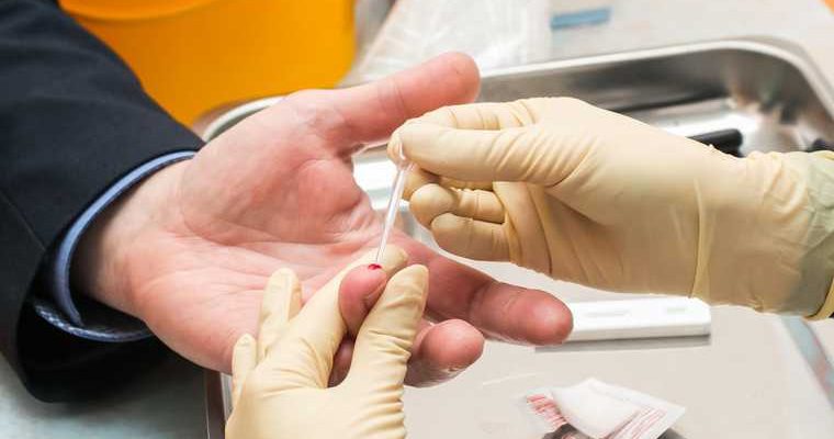 выявление ВИЧ Екатеринбург