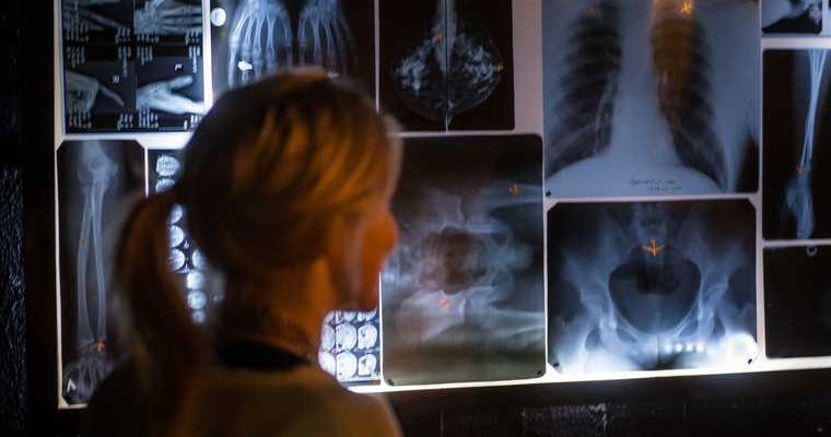 коронавирус обследование туберкулез рекомендация Минздрав