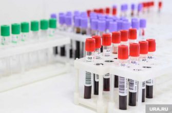 Гаффская болезнь в Тобольском районе