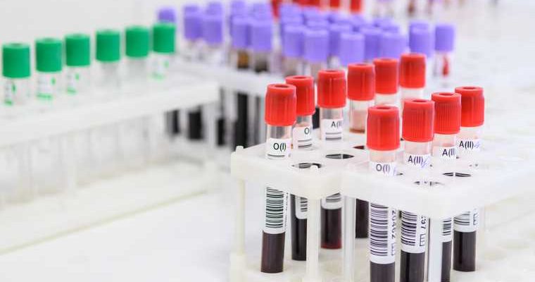 Гаффская болезнь в Тобольском районе